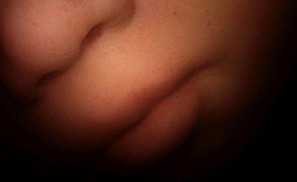 Life Before Birth